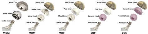 Bearing Surfaces in Total Hip Arthroplasty .